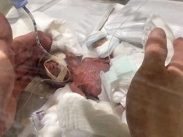 World's smallest baby boy goes home healthy from Japan hospital