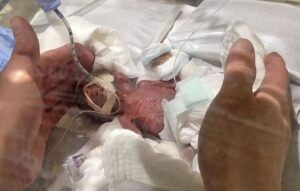 World's smallest baby boy goes home healthy from Japan hospital